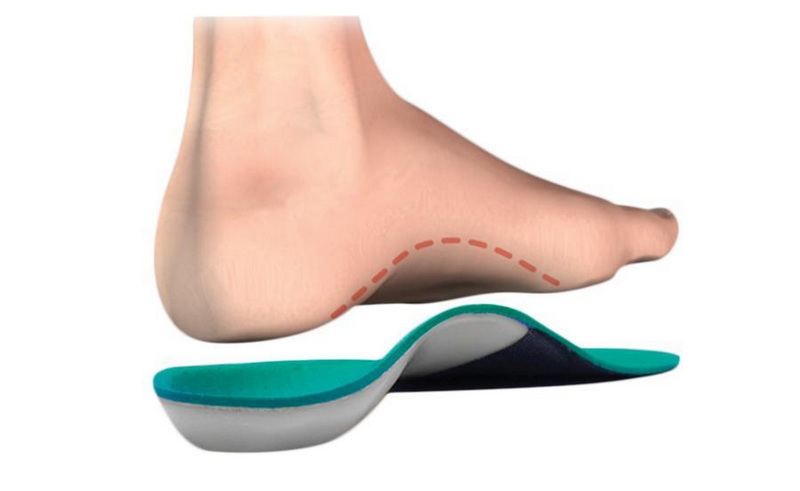 do orthotic insoles wear out