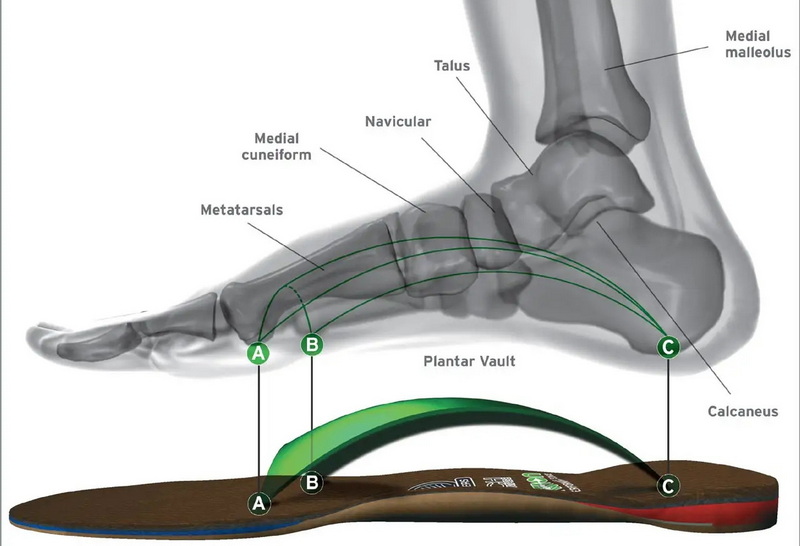 are dr scholl's arch insoles good
